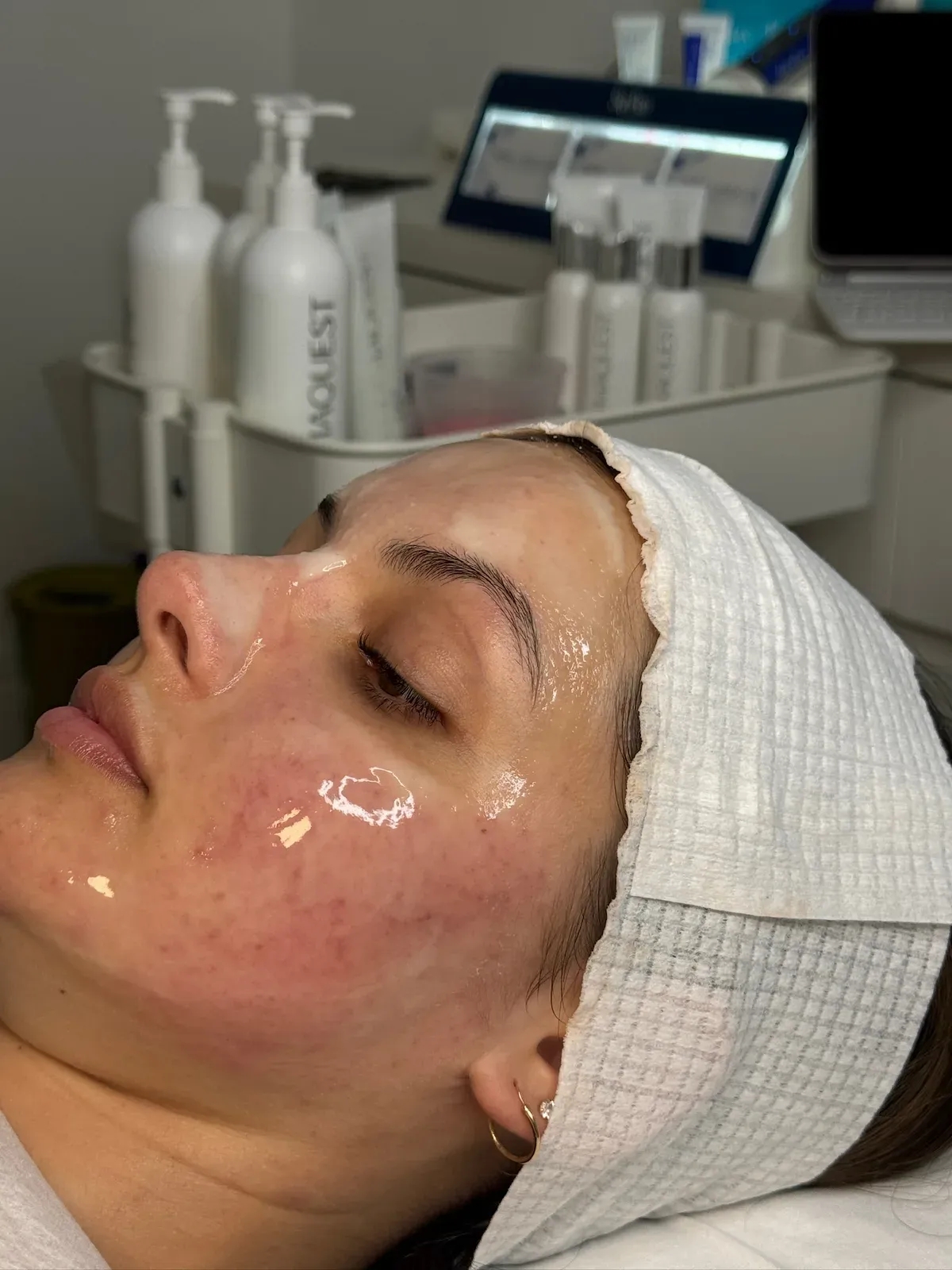 A client with a treatment applied to her skin