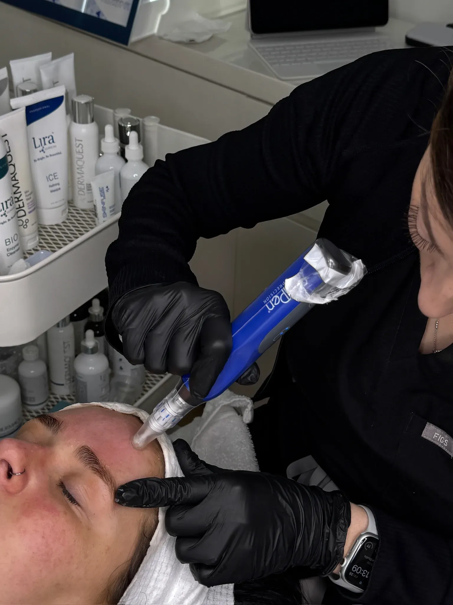 Emma using the SkinPen on a client at Pearl Skin Studio
